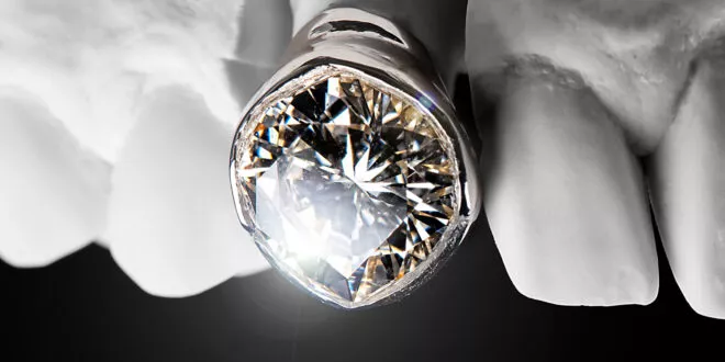 Post Malone - The Diamond Collection (Deluxe)